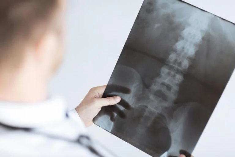 Radiologist and radiology services in 3071 Perry Ave, Bronx, NY 10467 — a doctor examines a spinal X-ray image, highlighting accurate diagnostics and advanced imaging care.
