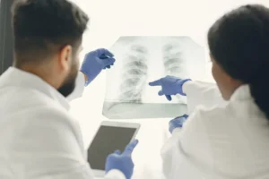 How to Prevent Pulmonary Embolism: Essential Tips to Know